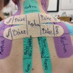 Kineziotaping